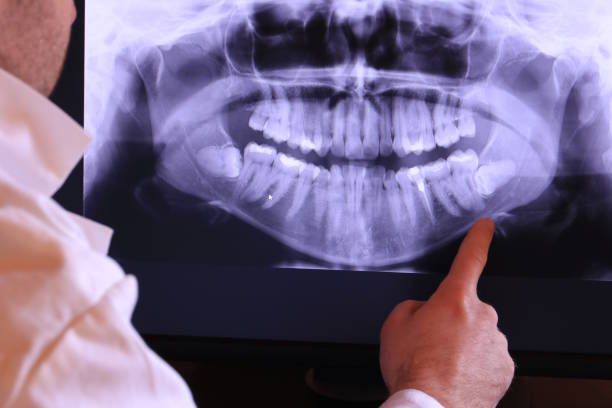 Best Emergency Dental Care for Broken or Chipped Teeth in Bristol, FL